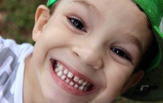 smiling boy who needs orthodontic braces