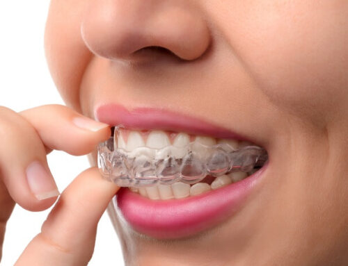 Know More About Invisalign From Your Professional Dentist Near You