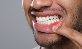 Gum Disease Prevention & Treatment