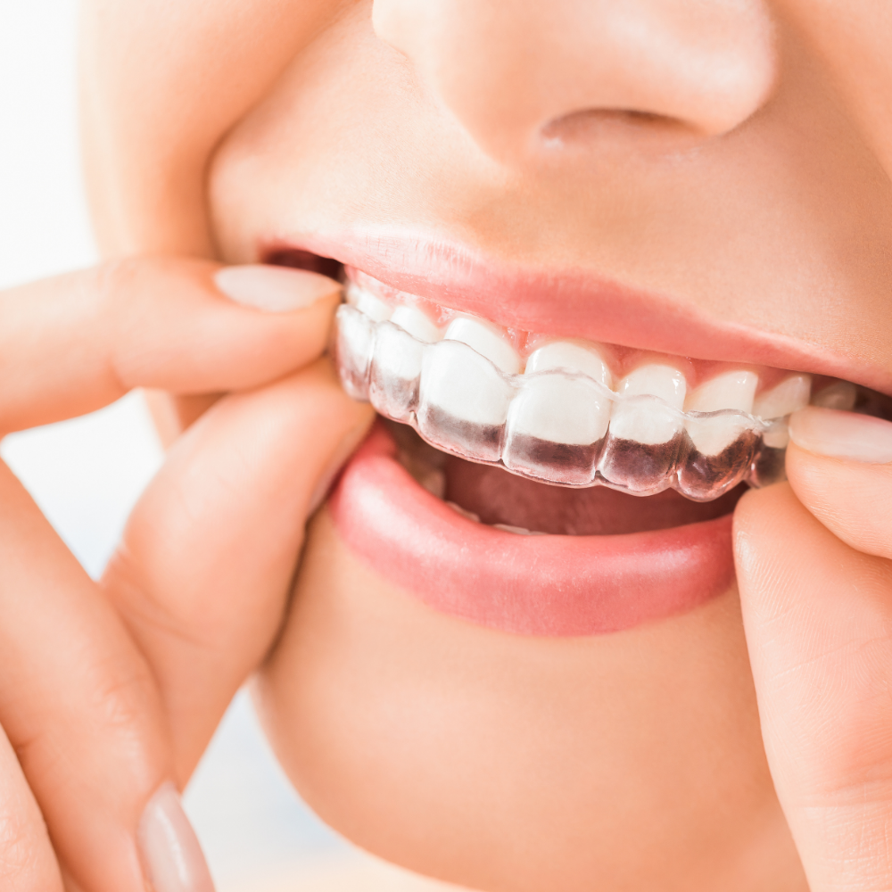 orthodontic milton ontario