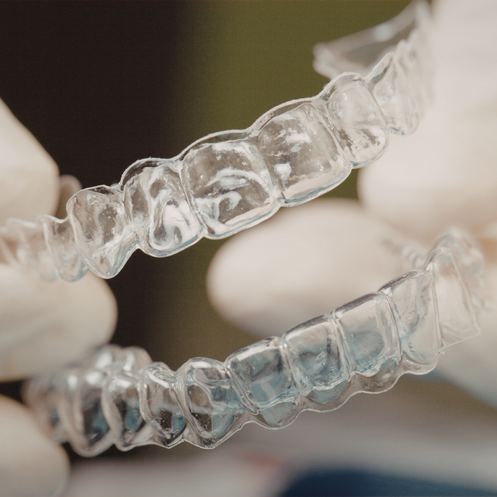 invisalign for teens milton 2